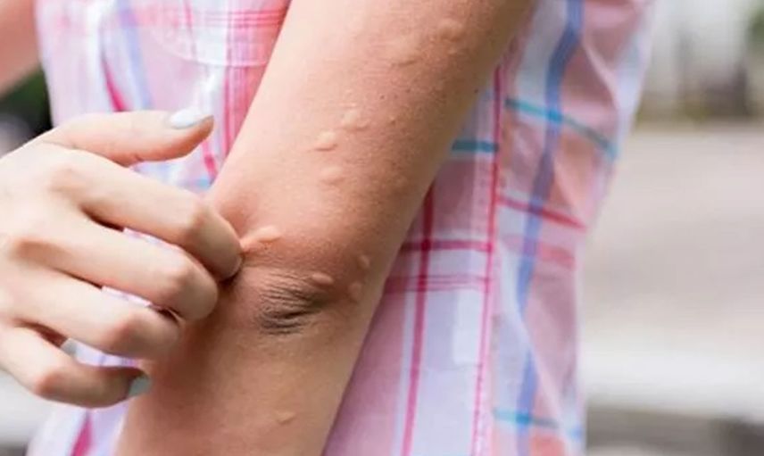 Tatile çıkacaklar dikkat: Sıtma vakaları giderek artıyor