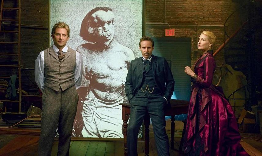 The Elephant Man – Fil Adam film konusu ve oyuncuları