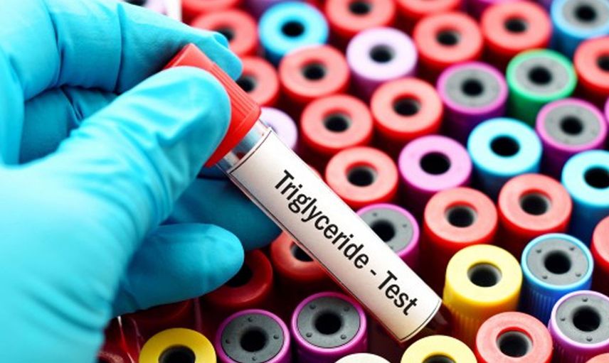 Trigliserid Nasıl Düşürülür?