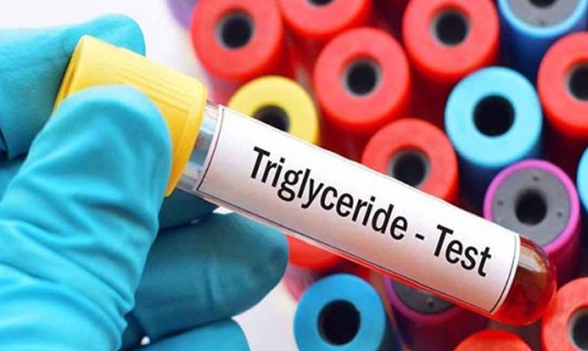 Trigliserid Nedir, Trigliserid Yüksekliği Nasıl Düşürülür? 