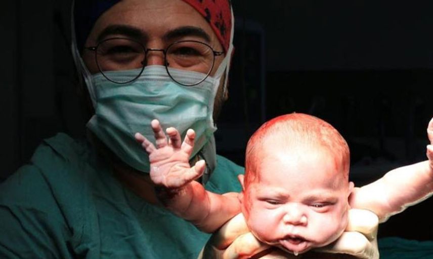 Van’da Burçak Bebek Birinciliği Getirdi