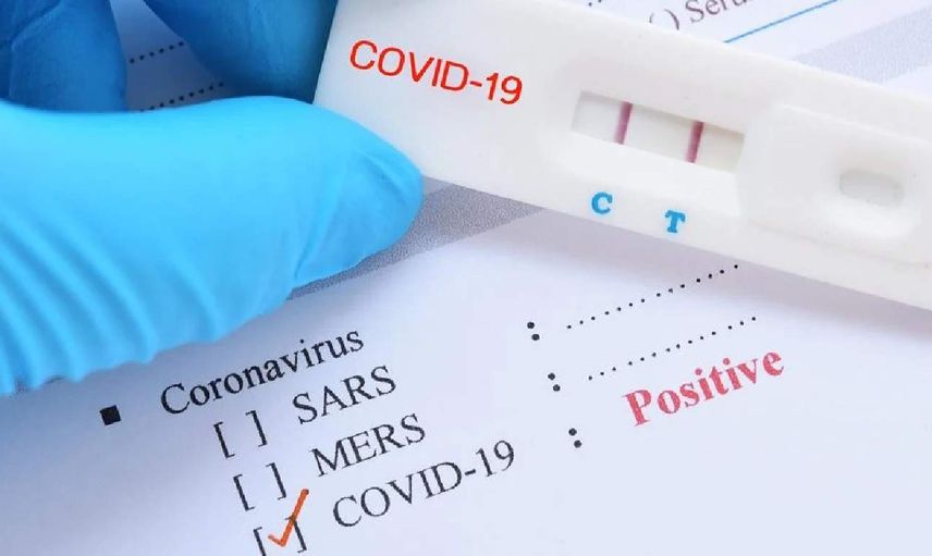 Yerli Ve Milli Kovid-19 Tanı Kiti,30 Dakikada Sonuç Veriyor! Kısa sürede sonuç veren bu test güvenilir mi?