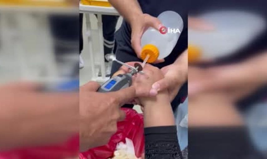 Yüzüğü parmağına sıkışan kadının yardımına itfaiye ekipleri koştu