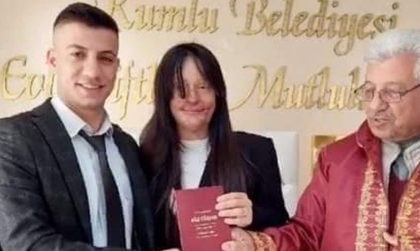 Yüzünü Asitle Yakan Sevgilisini Affeden Berfin Özek Ozan Çeltik'le Evlendi
